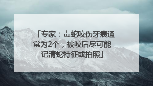 专家：毒蛇咬伤牙痕通常为2个，被咬后尽可能记清蛇特征或拍照